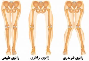 زانوی ضربدری